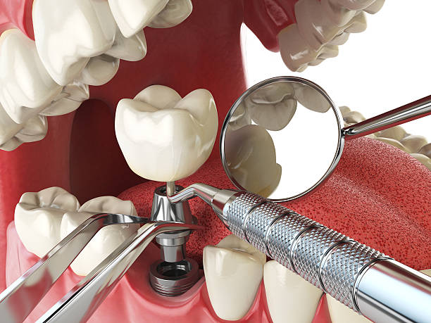 Best Weekend Emergency Dentist in Anderson, SC